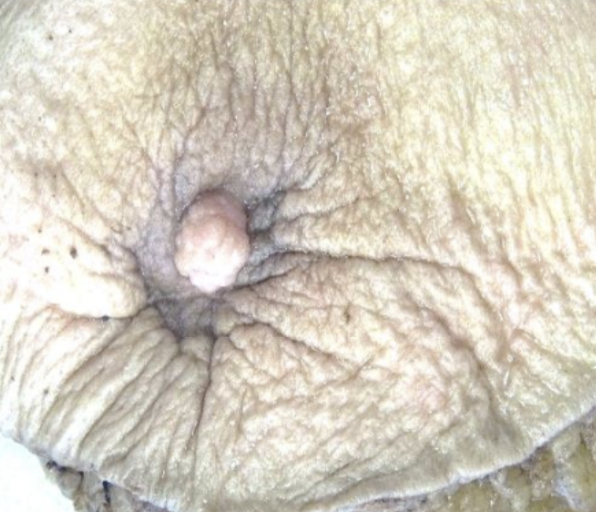 Description of the image